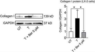 Development of a novel human triculture model of non-alcoholic fatty liver disease and identification of berberine as ameliorating steatosis, oxidative stress and fibrosis